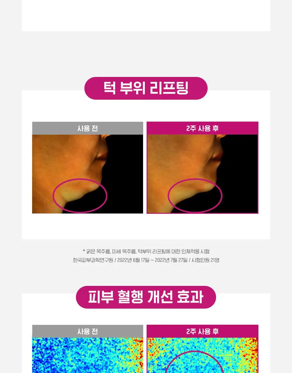 [227만개판매] CKD 레티노콜라겐 저분자 300 괄사 목주름 크림 50ml 1+1 기획 상세페이지 17